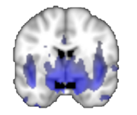 Peptides as Drugs